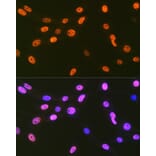 Immunofluorescence - Anti-EWSR1/EWS Antibody [ARC1674] (A307049) - Antibodies.com