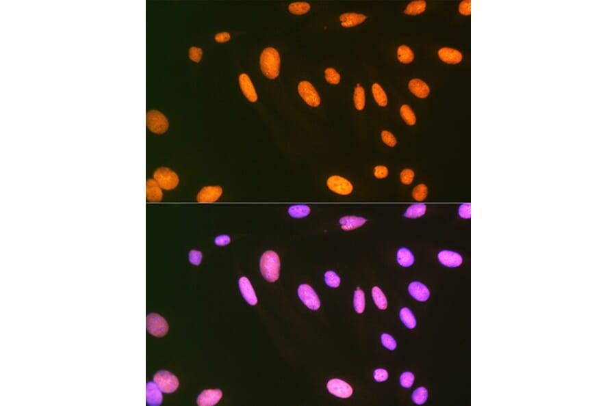 Immunofluorescence - Anti-EWSR1/EWS Antibody [ARC1674] (A307049) - Antibodies.com