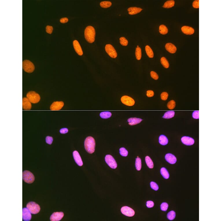 Immunofluorescence - Anti-EWSR1/EWS Antibody [ARC1674] (A307049) - Antibodies.com