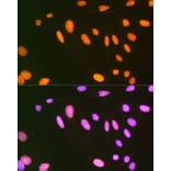 Immunofluorescence - Anti-EWSR1/EWS Antibody [ARC1674] (A307049) - Antibodies.com