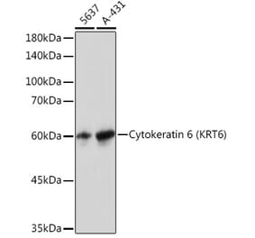 Western Blot - Anti-Cytokeratin 6a Antibody [ARC2142] (A307050) - Antibodies.com