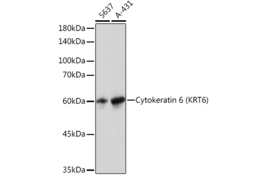 Western Blot - Anti-Cytokeratin 6a Antibody [ARC2142] (A307050) - Antibodies.com