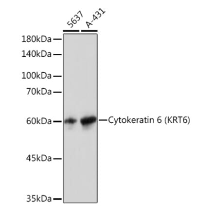 Western Blot - Anti-Cytokeratin 6a Antibody [ARC2142] (A307050) - Antibodies.com