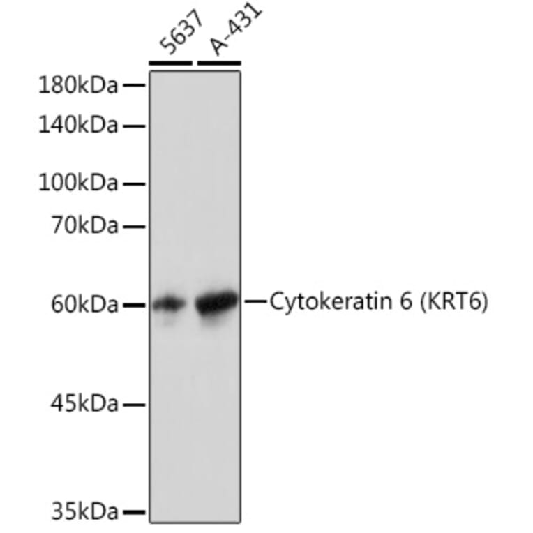 Western Blot - Anti-Cytokeratin 6a Antibody [ARC2142] (A307050) - Antibodies.com