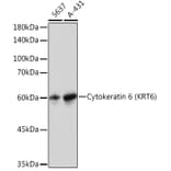 Western Blot - Anti-Cytokeratin 6a Antibody [ARC2142] (A307050) - Antibodies.com