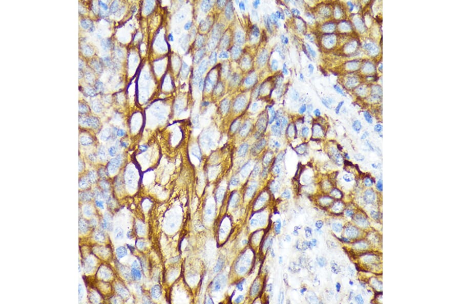 Immunohistochemistry - Anti-Cytokeratin 6a Antibody [ARC2142] (A307050) - Antibodies.com