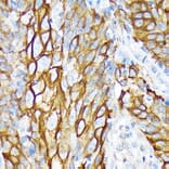 Immunohistochemistry - Anti-Cytokeratin 6a Antibody [ARC2142] (A307050) - Antibodies.com