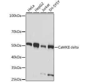 Western Blot - Anti-CaMKII delta Antibody [ARC1473] (A307051) - Antibodies.com