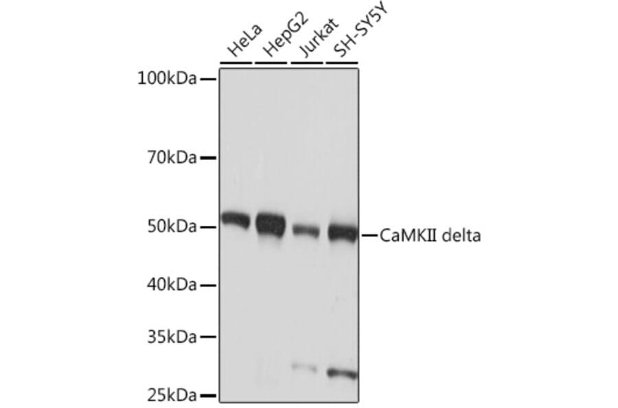 Western Blot - Anti-CaMKII delta Antibody [ARC1473] (A307051) - Antibodies.com