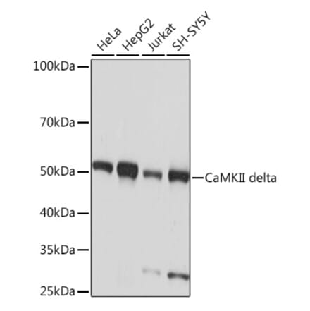 Western Blot - Anti-CaMKII delta Antibody [ARC1473] (A307051) - Antibodies.com