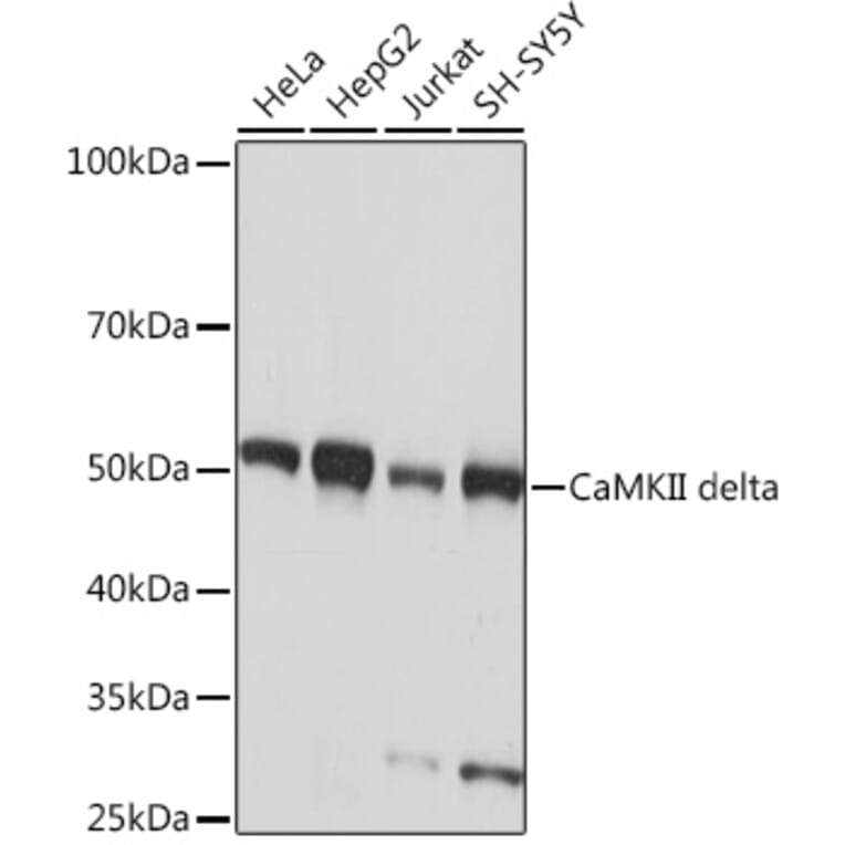 Western Blot - Anti-CaMKII delta Antibody [ARC1473] (A307051) - Antibodies.com