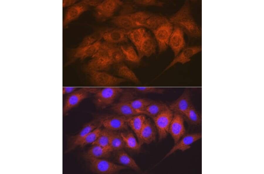 Immunofluorescence - Anti-CaMKII delta Antibody [ARC1473] (A307051) - Antibodies.com