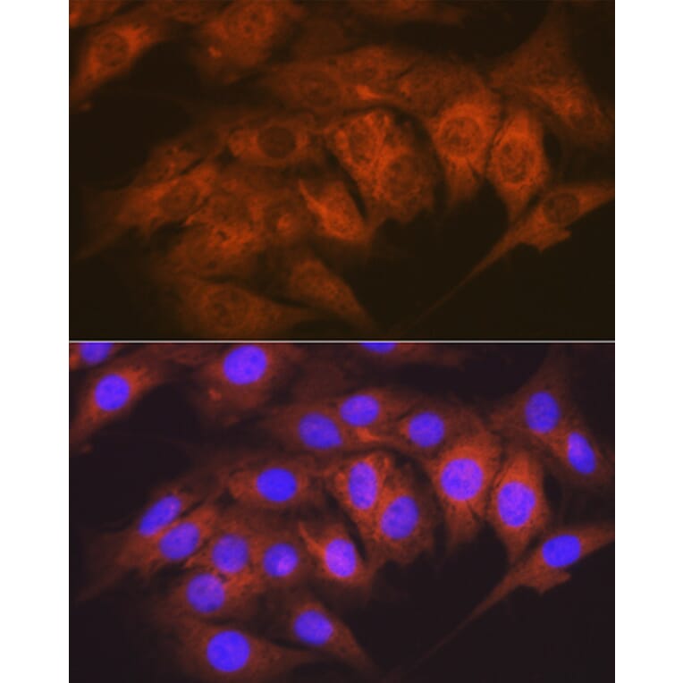 Immunofluorescence - Anti-CaMKII delta Antibody [ARC1473] (A307051) - Antibodies.com