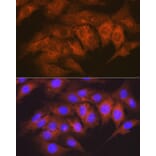 Immunofluorescence - Anti-CaMKII delta Antibody [ARC1473] (A307051) - Antibodies.com