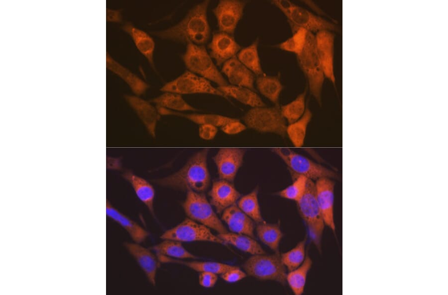 Immunofluorescence - Anti-CaMKII delta Antibody [ARC1473] (A307051) - Antibodies.com