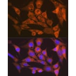 Immunofluorescence - Anti-CaMKII delta Antibody [ARC1473] (A307051) - Antibodies.com