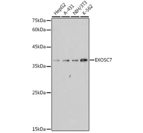 Western Blot - Anti-RRP42 Antibody [ARC2510] (A307052) - Antibodies.com
