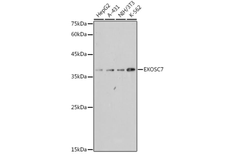 Western Blot - Anti-RRP42 Antibody [ARC2510] (A307052) - Antibodies.com
