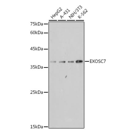 Western Blot - Anti-RRP42 Antibody [ARC2510] (A307052) - Antibodies.com