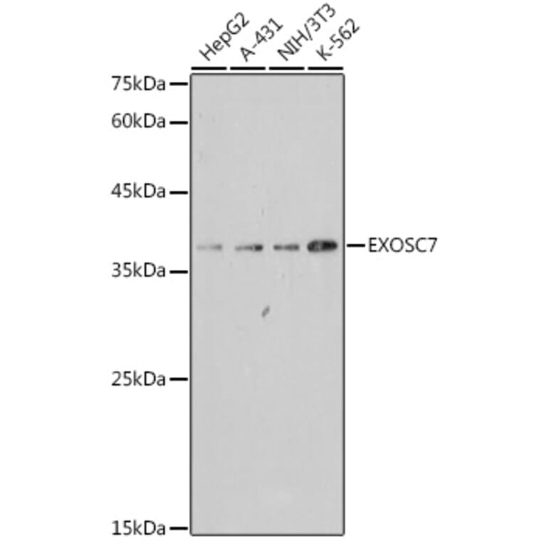 Western Blot - Anti-RRP42 Antibody [ARC2510] (A307052) - Antibodies.com