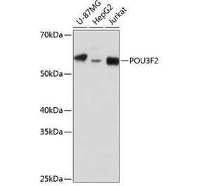 Western Blot - Anti-Brn-2 Antibody (A307053) - Antibodies.com