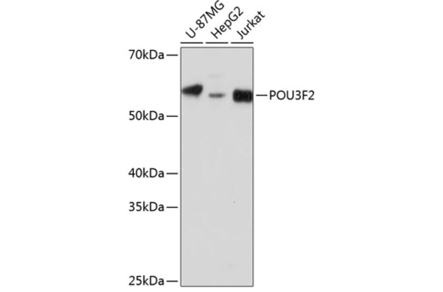 Western Blot - Anti-Brn-2 Antibody (A307053) - Antibodies.com