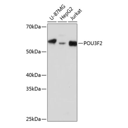 Western Blot - Anti-Brn-2 Antibody (A307053) - Antibodies.com