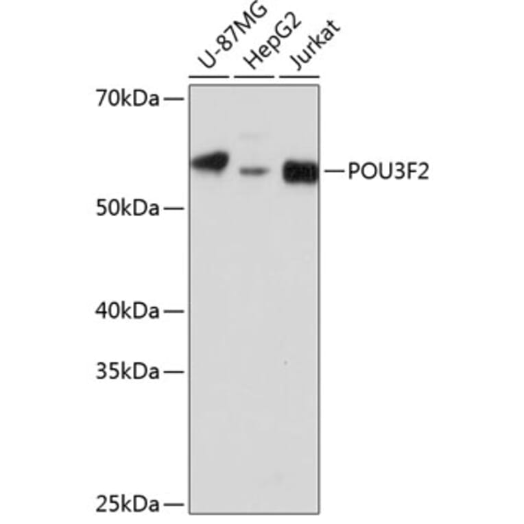 Western Blot - Anti-Brn-2 Antibody (A307053) - Antibodies.com