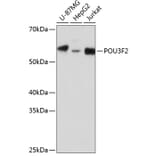 Western Blot - Anti-Brn-2 Antibody (A307053) - Antibodies.com