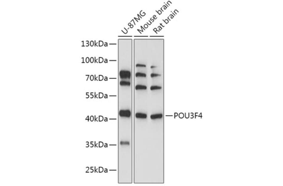 Western Blot - Anti-BRN4 Antibody (A307054) - Antibodies.com