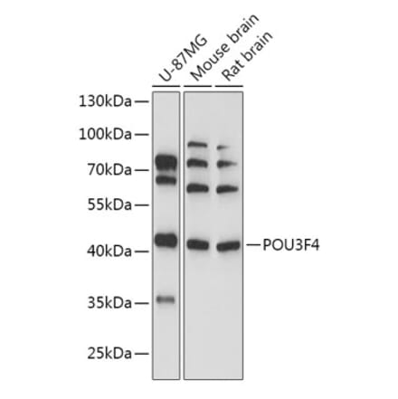 Western Blot - Anti-BRN4 Antibody (A307054) - Antibodies.com