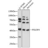 Western Blot - Anti-BRN4 Antibody (A307054) - Antibodies.com