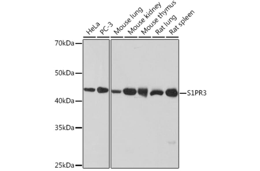 Western Blot - Anti-EDG3/S1P3 Antibody [ARC1877] (A307055) - Antibodies.com