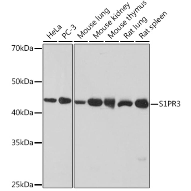 Western Blot - Anti-EDG3/S1P3 Antibody [ARC1877] (A307055) - Antibodies.com