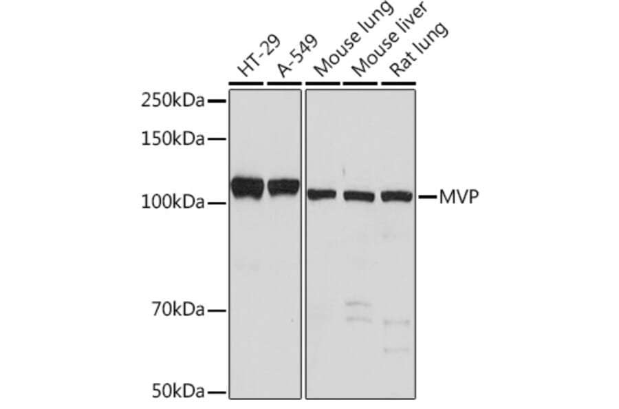 Western Blot - Anti-MVP Antibody [ARC1855] (A307056) - Antibodies.com