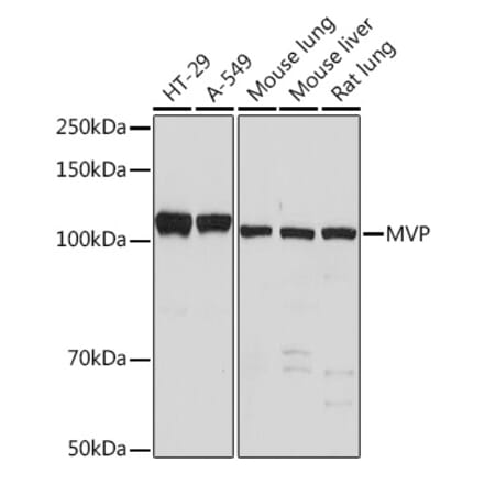 Western Blot - Anti-MVP Antibody [ARC1855] (A307056) - Antibodies.com