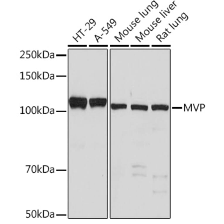 Western Blot - Anti-MVP Antibody [ARC1855] (A307056) - Antibodies.com