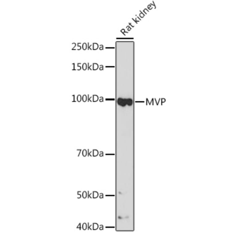 Western Blot - Anti-MVP Antibody [ARC1855] (A307056) - Antibodies.com