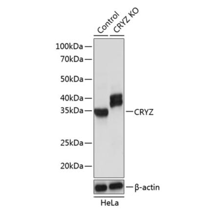 Western Blot - Anti-Quinone oxidoreductase Antibody (A307058) - Antibodies.com