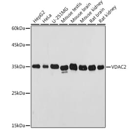 Western Blot - Anti-VDAC2 Antibody (A307060) - Antibodies.com