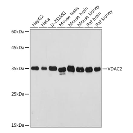 Western Blot - Anti-VDAC2 Antibody (A307060) - Antibodies.com