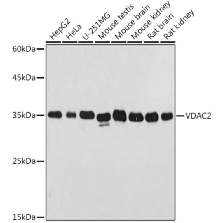 Western Blot - Anti-VDAC2 Antibody (A307060) - Antibodies.com