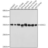 Western Blot - Anti-VDAC2 Antibody (A307060) - Antibodies.com