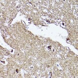 Immunohistochemistry - Anti-VDAC2 Antibody (A307060) - Antibodies.com