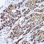 Immunohistochemistry - Anti-VDAC2 Antibody (A307060) - Antibodies.com