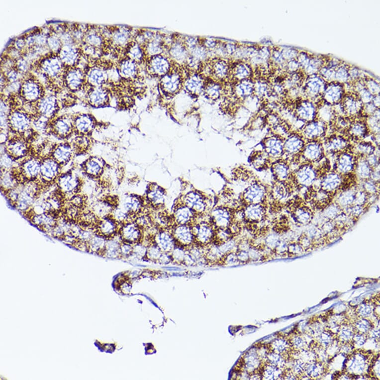 Immunohistochemistry - Anti-VDAC2 Antibody (A307060) - Antibodies.com