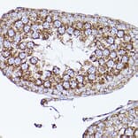 Immunohistochemistry - Anti-VDAC2 Antibody (A307060) - Antibodies.com