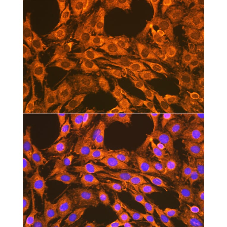 Immunofluorescence - Anti-VDAC2 Antibody (A307060) - Antibodies.com