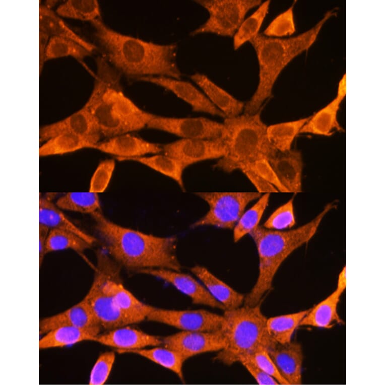 Immunofluorescence - Anti-VDAC2 Antibody (A307060) - Antibodies.com