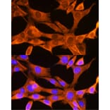 Immunofluorescence - Anti-VDAC2 Antibody (A307060) - Antibodies.com